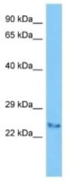 TLCD3A Rabbit anti-Human, Polyclonal, Novus Biologicals 100 &mu;g | Buy Online | Novus Biologicals | Fisher Scientific